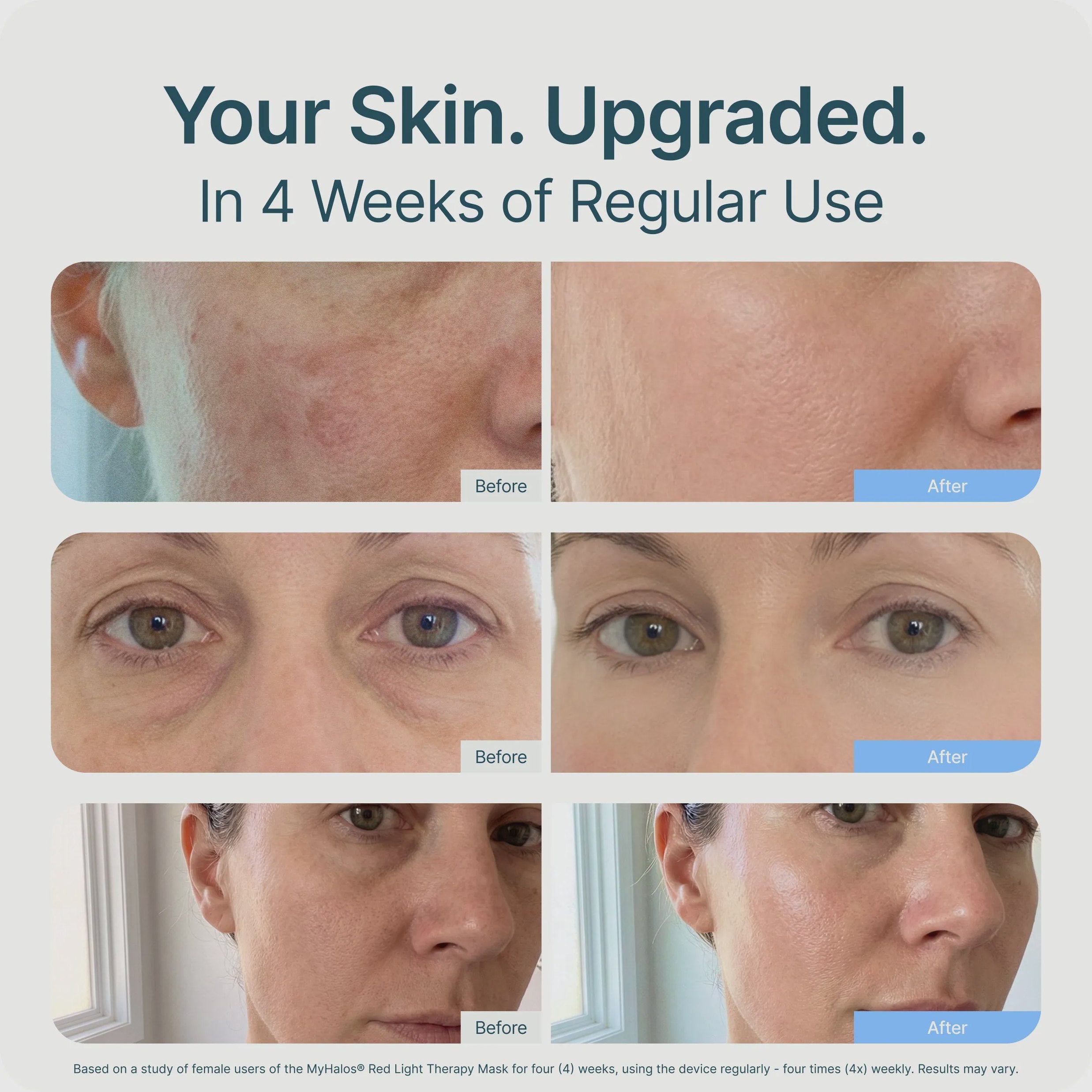 Red Light Therapy Face Mask